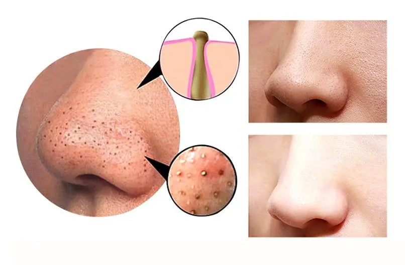 4-in-1 Electric Facial & Body Gua Sha Cupping Cleaner uniglowStore