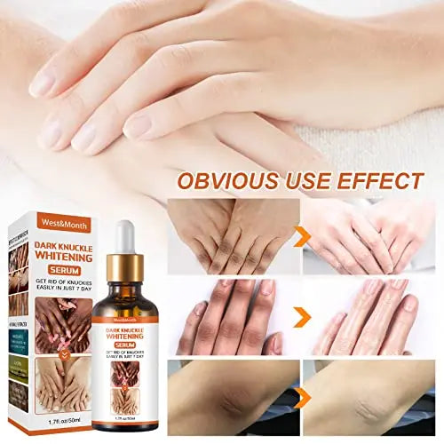 Advanced Skin Brightening Serum – Radiant Glow uniglow