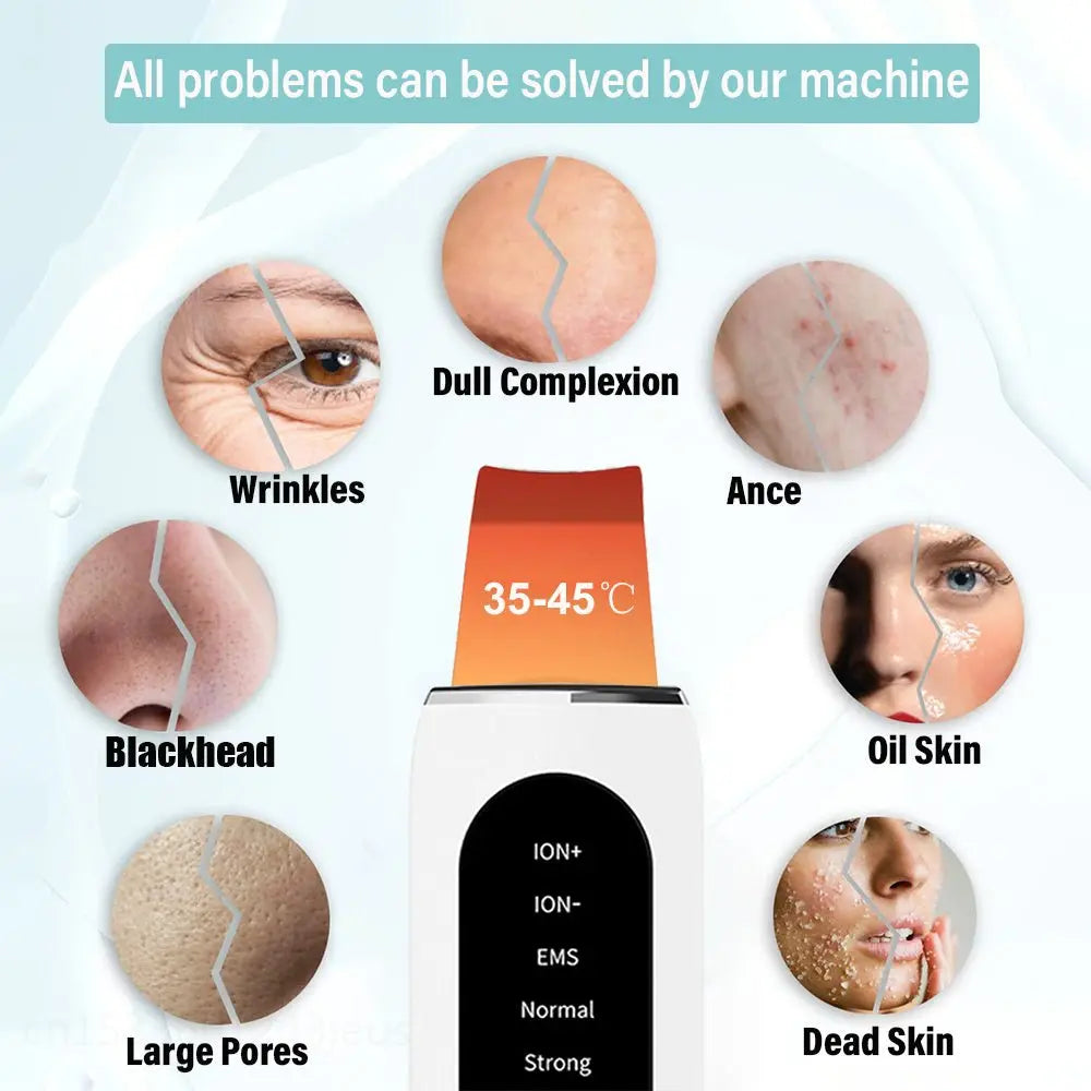 Ultrasonic Skin Scrubber & Blackhead Remover with Microcurrent & LED Light Therapy uniglowStore
