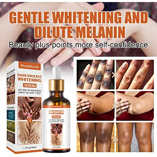 Advanced Skin Brightening Serum – Radiant Glow uniglow