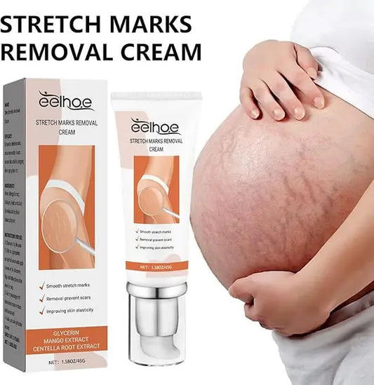 Eelhoe - Stretch Marks Removal Cream (Original) uniglow