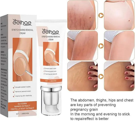 Eelhoe - Stretch Marks Removal Cream (Original) uniglow