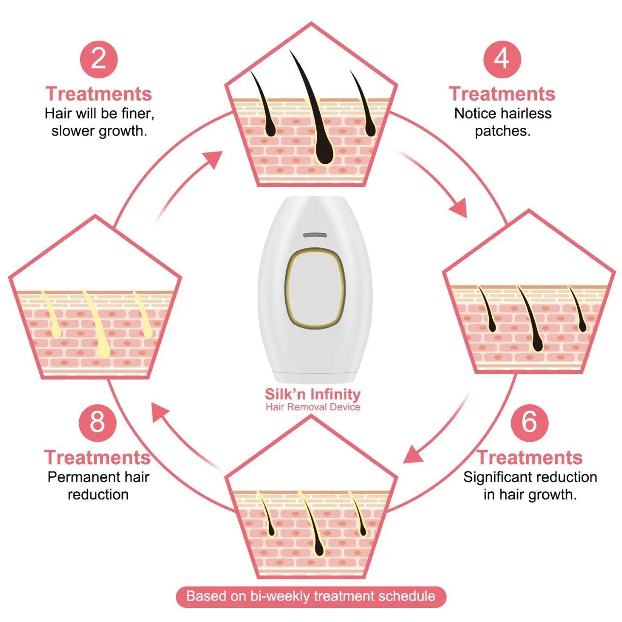 Freezing Point IPL Laser Hair Removal Device – Painless Handheld Beauty Tool for Face & Body uniglowStore
