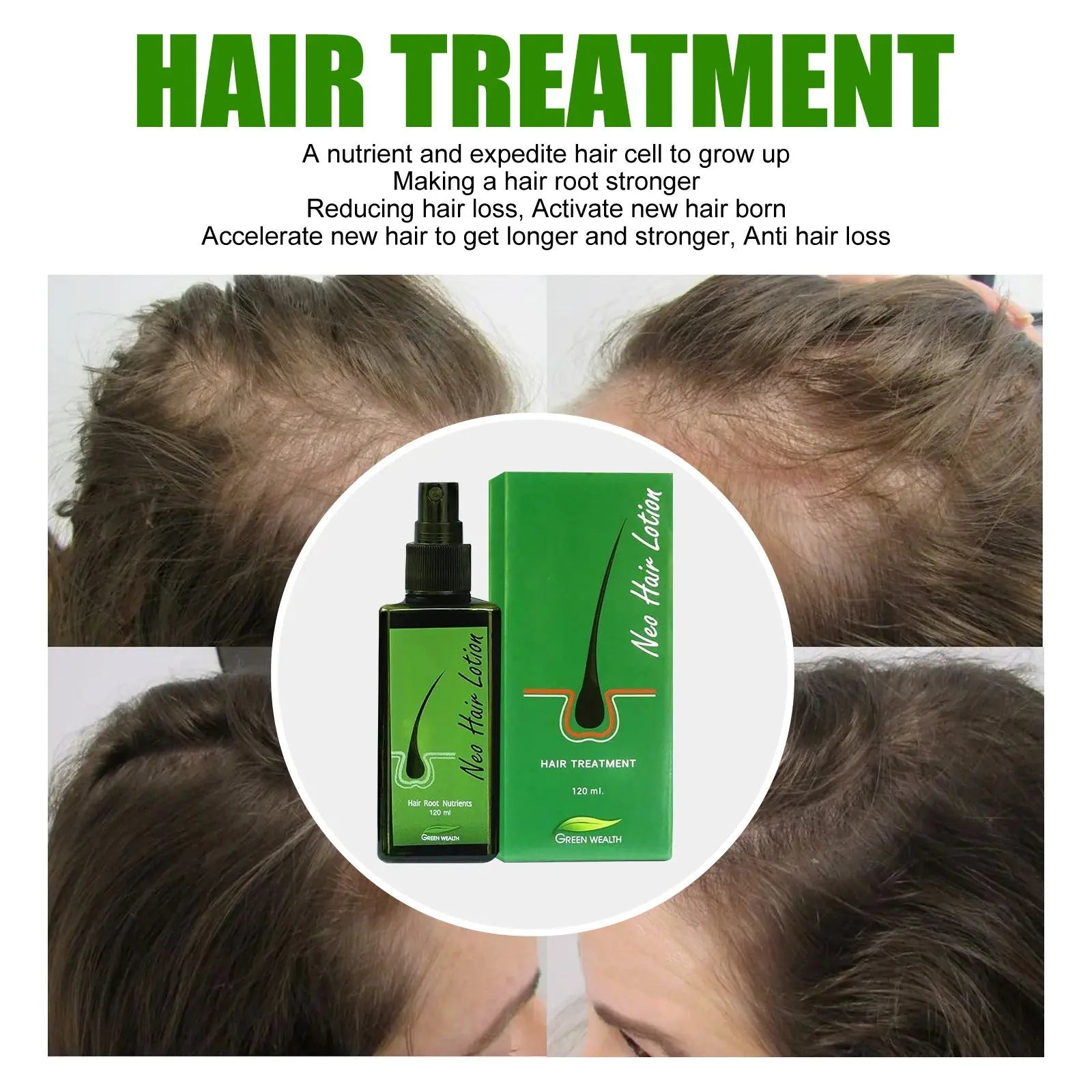 Hair Care Growth Lotion Spray uniglow
