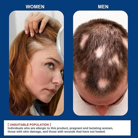 Hair Growth Cream – Nourish, Strengthen & Revitalize Your Hair - Uniglowstore
