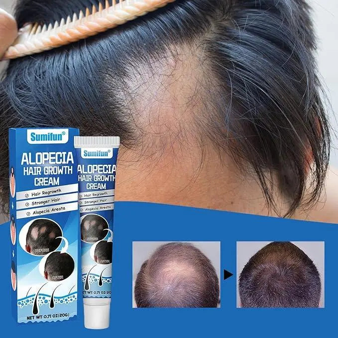 Hair Growth Cream – Nourish, Strengthen & Revitalize Your Hair - Uniglowstore