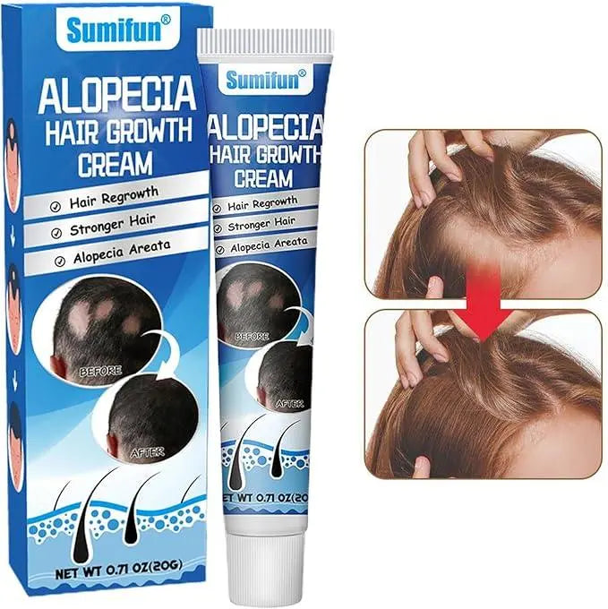 Hair Growth Cream – Nourish, Strengthen & Revitalize Your Hair - Uniglowstore