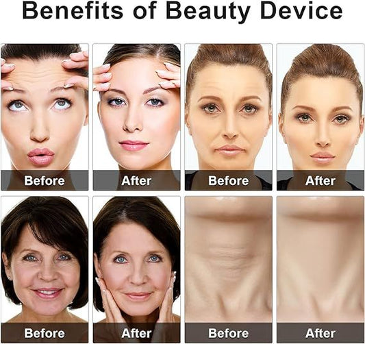 Rechargeable Eye Beauty Device – Anti-Aging & Eye Massage Tool