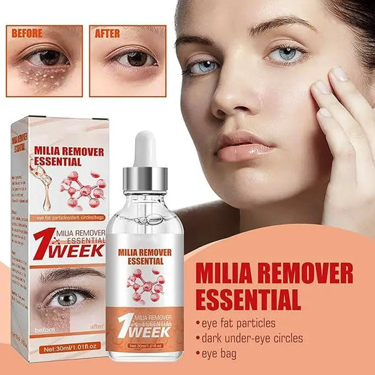 Smooth Milia Remover Serum Gentle Treatment for Clear, Smooth Skin - Uniglowstore