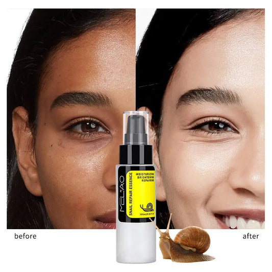 Snail Skin Care Facial Care Solution uniglowStore