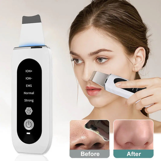 Ultrasonic Skin Scrubber & Blackhead Remover with Microcurrent & LED Light Therapy uniglowStore